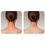 Thermio Neck & Shoulder Massager with Heat Therapy, 10W (3 Modes, 2000mAh) - Black - تصویر 6